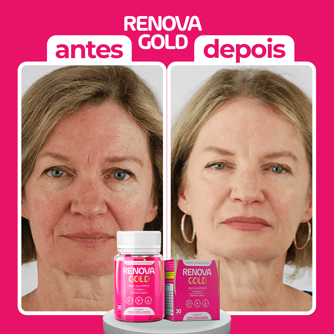 Antes-e-depois3